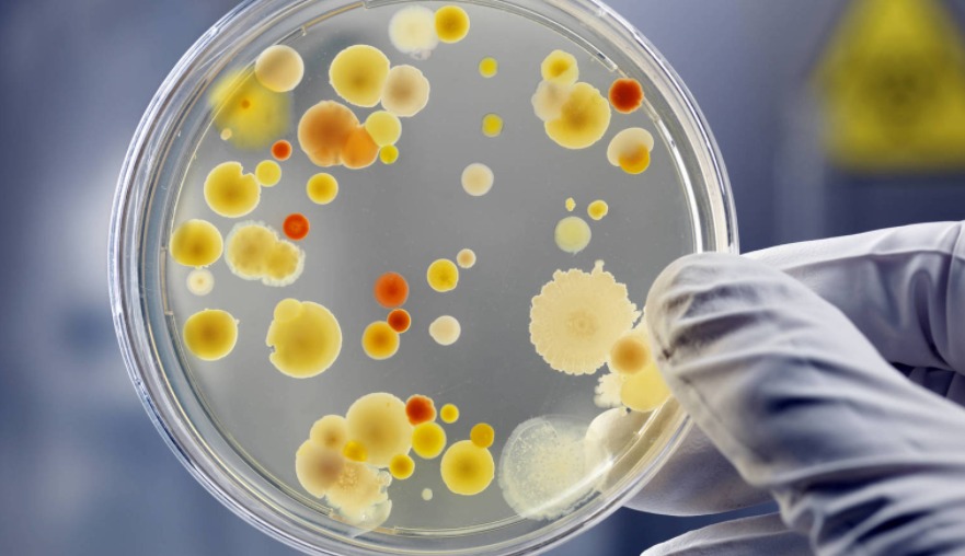 El “súper hongo” Candida auris se sigue propagando por EEUU y hay dos  brotes en curso | Canariasenred - Noticias de Canarias