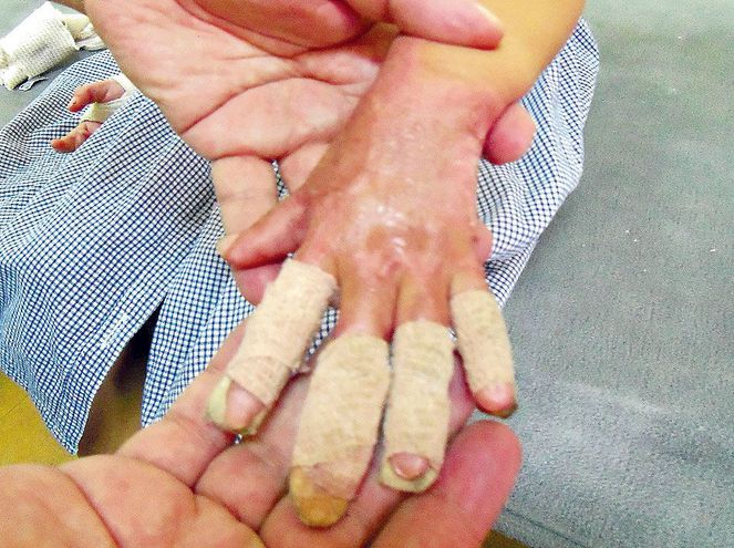 Mantiene Fundación Shriners atenciones hacia menores