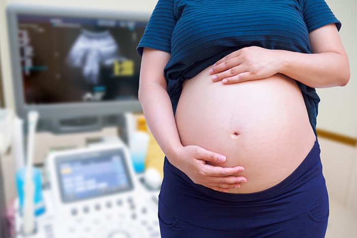 Embarazadas podrán solicitar vacuna anticovid en la región Centro