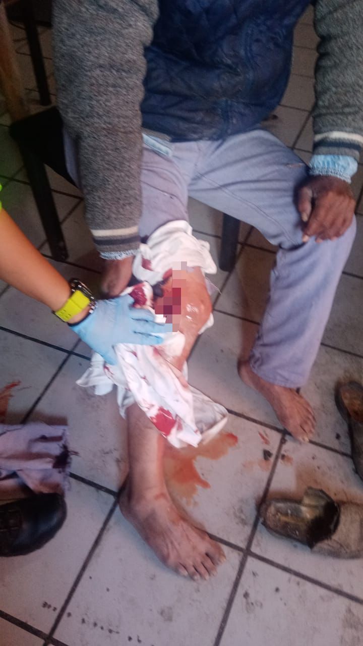 Se lesiona la pierna con pulidor.