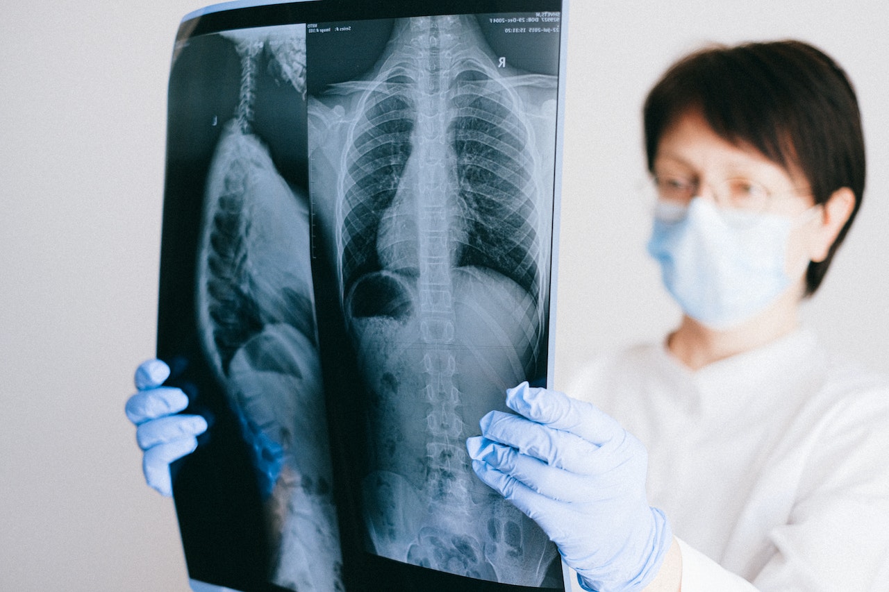 Hospital Universitario tendrá un área renovada de radiología e imagen