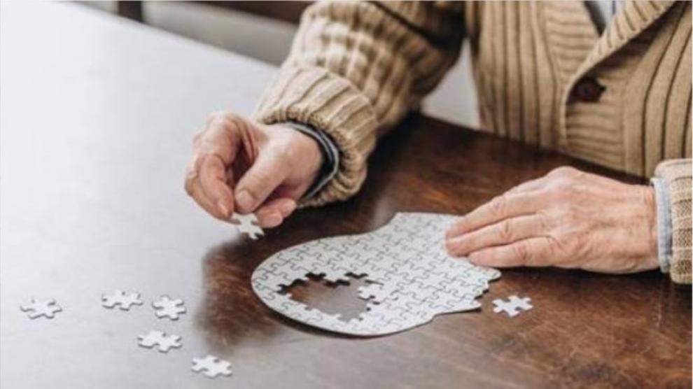Invitan a actualizarse en enfermedad de Alzheimer