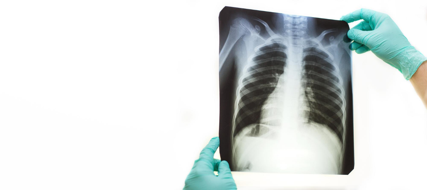 Recomiendan no llevar a clases a estudiantes con síntomas de males respiratorios