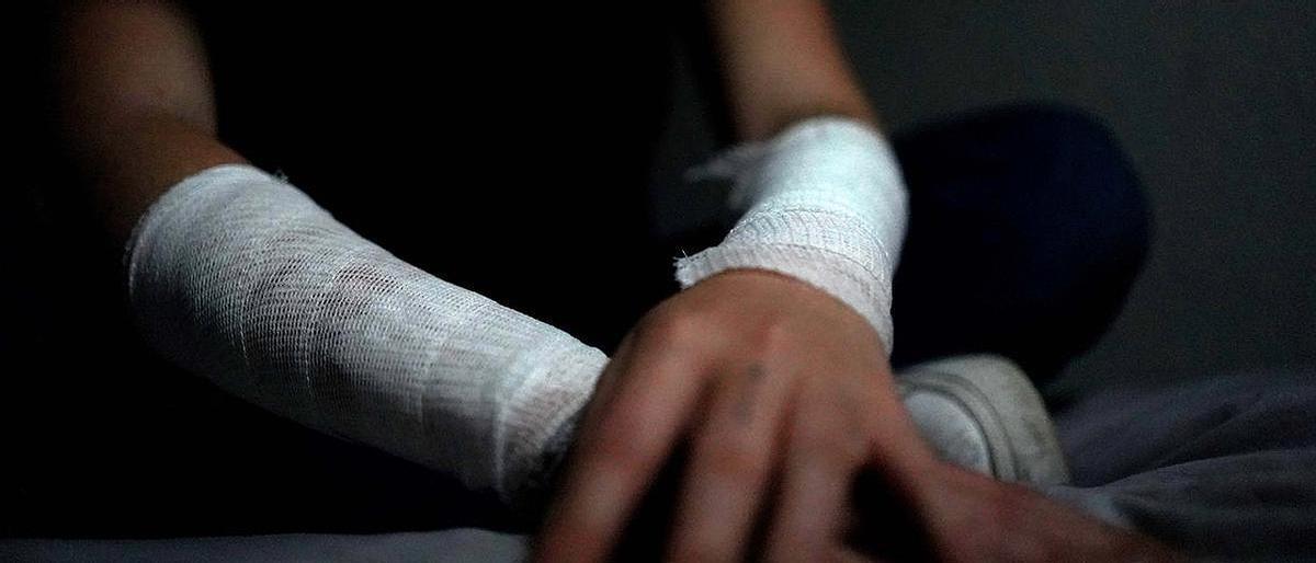 Alarma a maestros y padres de familia ‘cutting’ entre menores