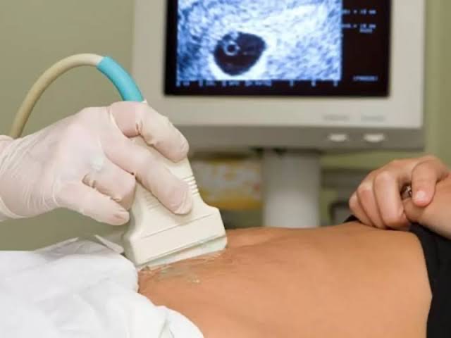 Mujeres de otros estados buscan abortar en Coahuila